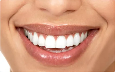 odonto estetica